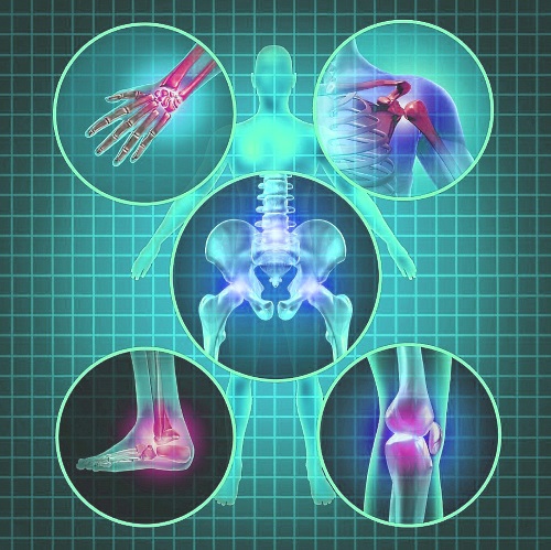 Заболевания суставов. Симптомы и причины