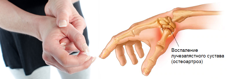 Почему болит средний палец правой руки?
