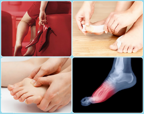Боль в суставе большого пальца ноги: внутренние причины