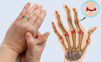 Как сделать рентген пальцев ног, рук: подготовка к процедуре
