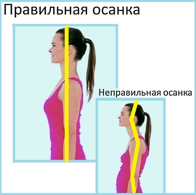 Боли в шее - причины боли в шее, при каких заболеваниях возникает, диагностика и методы лечения