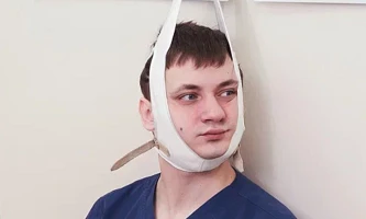 Что такое шейный кифоз?