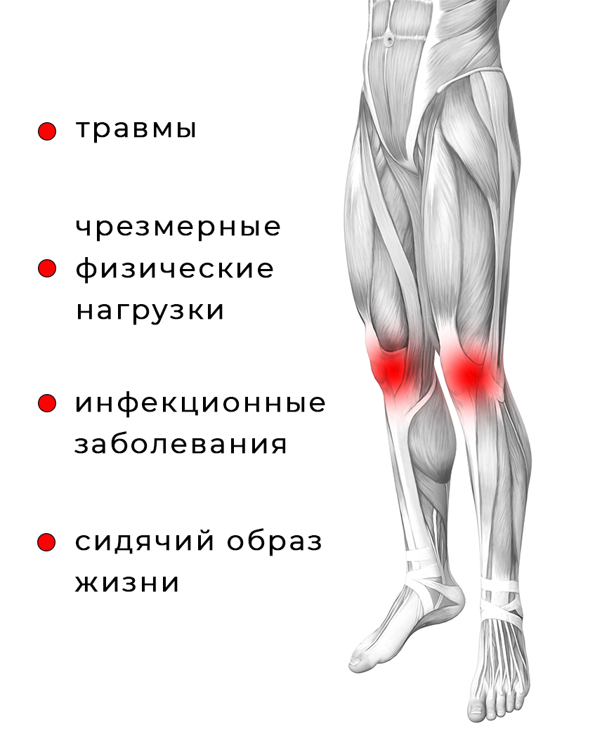 Сильно болят ноги в коленях