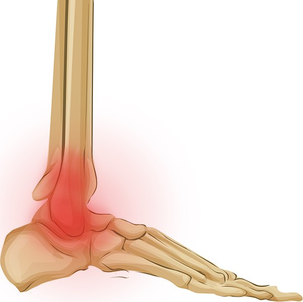 dureri la nivelul genunchiului decât ungerea din experiență în tratamentul artrozei