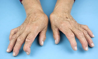 Палец опух почему возникает: причины и лечение опухоли пальца