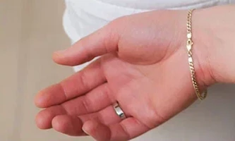 Шишки на пальцах рук - Как затормозить деформацию суставов