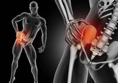 Невропатия седалищного нерва и артроз тазобедренного сустава
